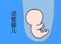 培养温州捐卵宝宝艺术细胞的小技巧